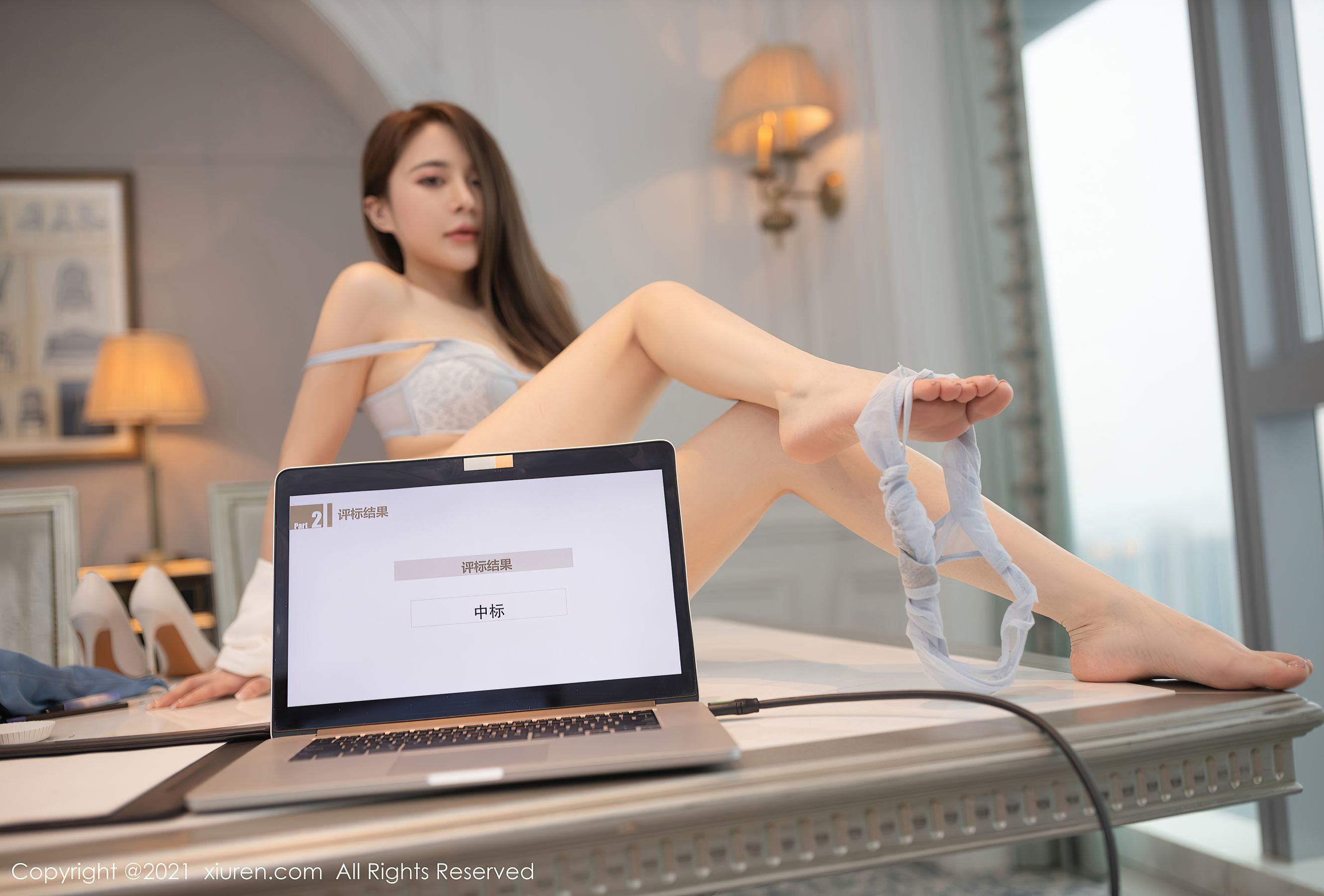 Xiuren] Số 3477 Caviar Fish