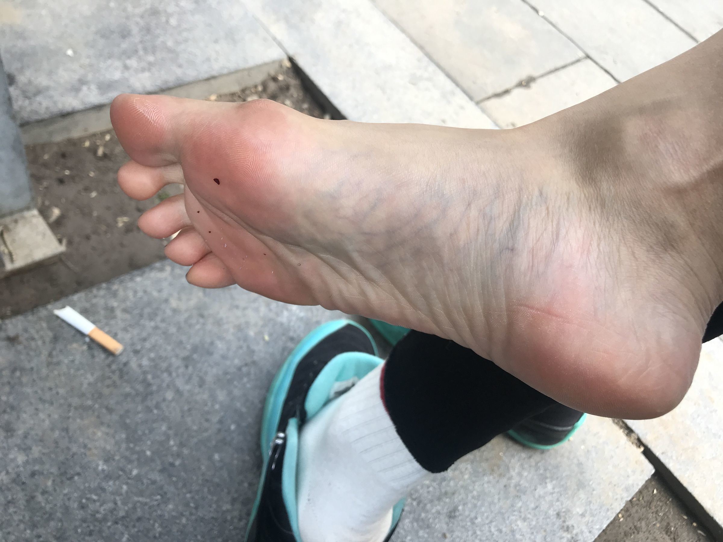 Welfare COS] An Qiao Qiao Er (Nia Qiao Qiao) No. 002 Outdoor Bare Feet