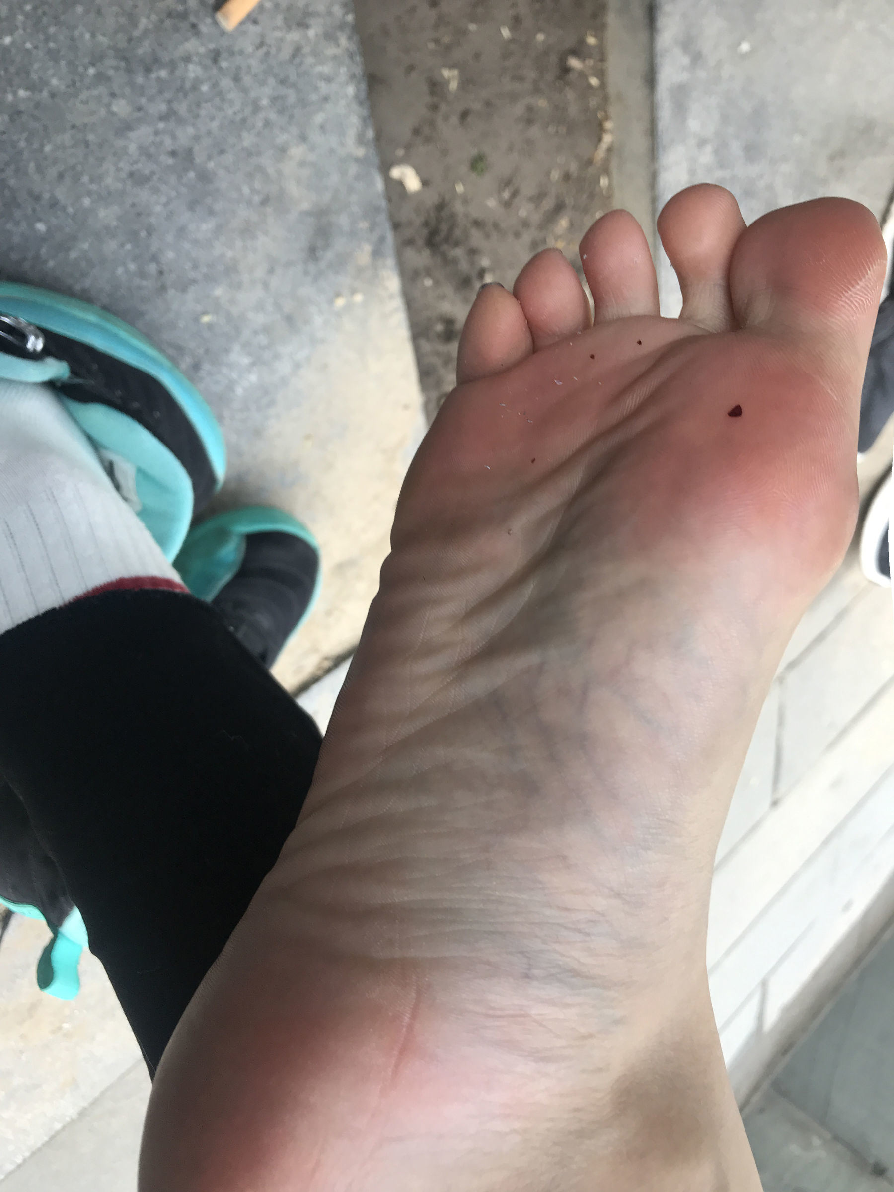 Welfare COS] An Qiao Qiao Er (Nia Qiao Qiao) No. 002 Outdoor Bare Feet